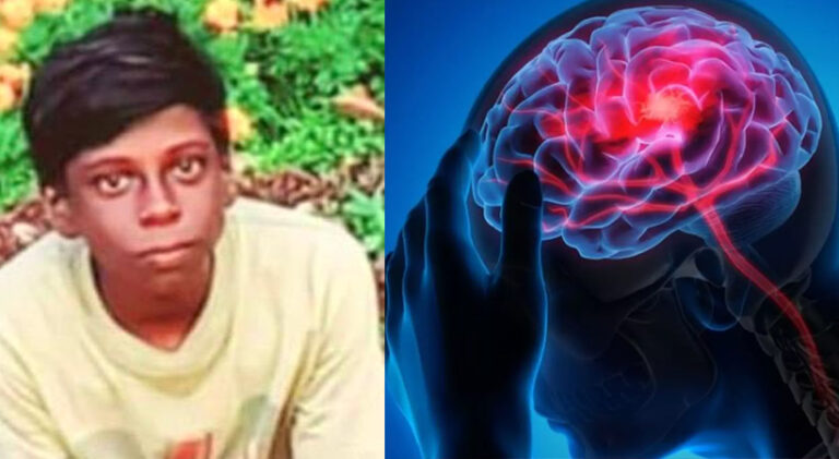  അമീബിക് മസ്തിഷ്കജ്വരം; കോഴിക്കോട് ചികിത്സയിലായിരുന്ന പതിനാലുകാരൻ മരിച്ചു