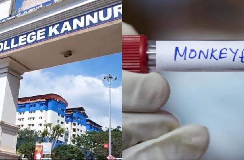  കണ്ണൂരിൽ വിദേശത്ത് നിന്നെത്തിയ യുവതിക്ക് എം പോക്സെന്ന് സംശയം