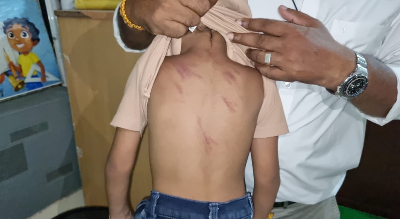  മട്ടാഞ്ചേരിയിൽ മൂന്നര വയസ്സുകാരനെ അധ്യാപിക ചൂരലിന് തല്ലി പരിക്കേൽപ്പിച്ചു