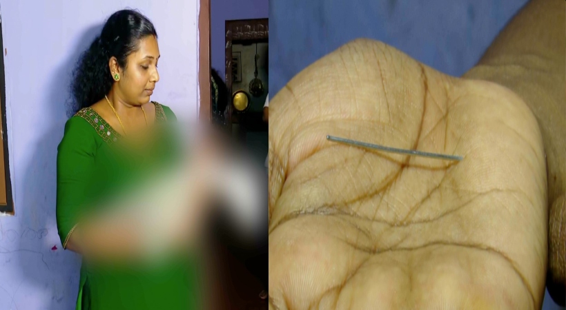  കണ്ണൂർ പരിയാരം ഗവ. മെഡിക്കൽ കോളജിൽ ചികിത്സ പിഴവെന്ന് പരാതി