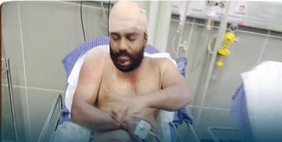  കണ്ണൂർ പാനൂർ പൊയിലൂരിൽ ബിജെപി പ്രവർത്തകന് വെട്ടേറ്റു