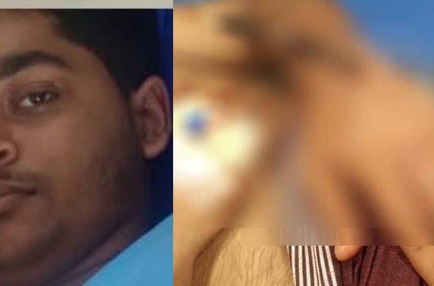  കണ്ണൂർ കൂത്തുപറമ്പ് കണ്ടേരിയിൽ മുള്ളൻ പന്നിയുടെ ആക്രമണത്തിൽ പ്ലസ് വൺ വിദ്യാർത്ഥിക്ക് പരിക്ക്