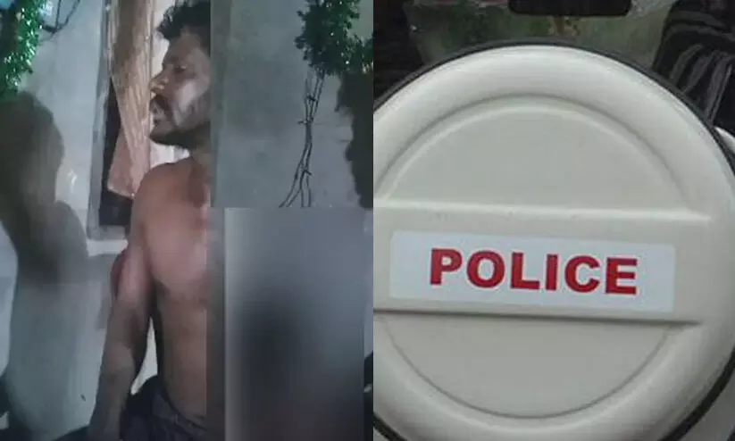  കണ്ണൂരിൽ എട്ടുവയസ്സുകാരിയെ ക്രൂരമായി മർദ്ദിച്ച സംഭവത്തിൽ പിതാവിന്റെ മൊഴി വിശ്വസിക്കാതെ പൊലീസ്