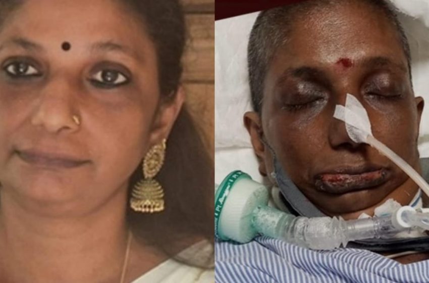  കണ്ണപുരം പൂമാലക്കാവിന് സമീപത്തെ കെ വി പ്രശാന്തി തുടർ ചികിത്സയ്ക്കായി ഉദാരമതികളുടെ സഹായം തേടുന്നു