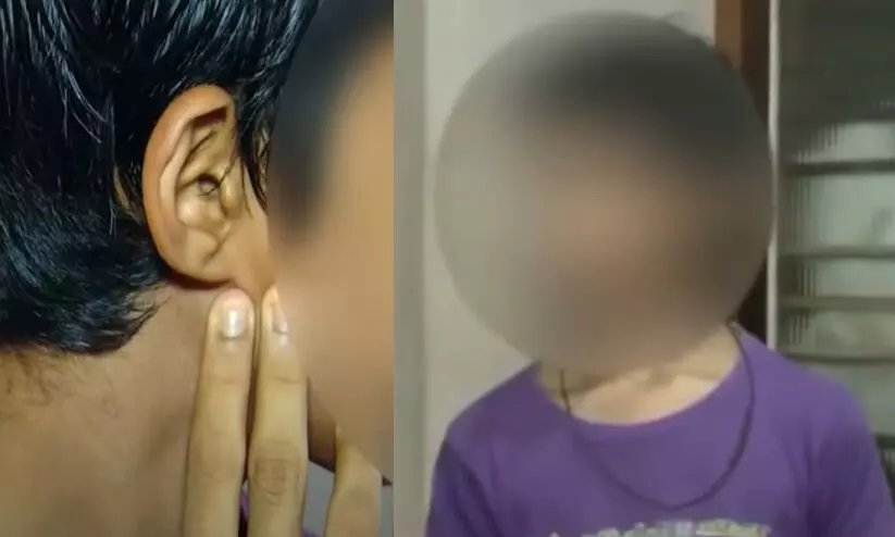  കാസർഗോഡ് പ്രധാനാധ്യാപകന്റെ അടിയേറ്റ് വിദ്യാർഥിയുടെ കർണ്ണപുടം പൊട്ടിയ സംഭവം; DDE അന്വേഷിക്കും