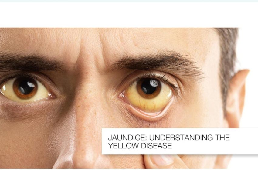  മഞ്ഞപ്പിത്ത വ്യാപനം; തളിപ്പറമ്പ് താലൂക്കിൽ പ്രത്യേക ജാഗ്രതാനിർദേശം