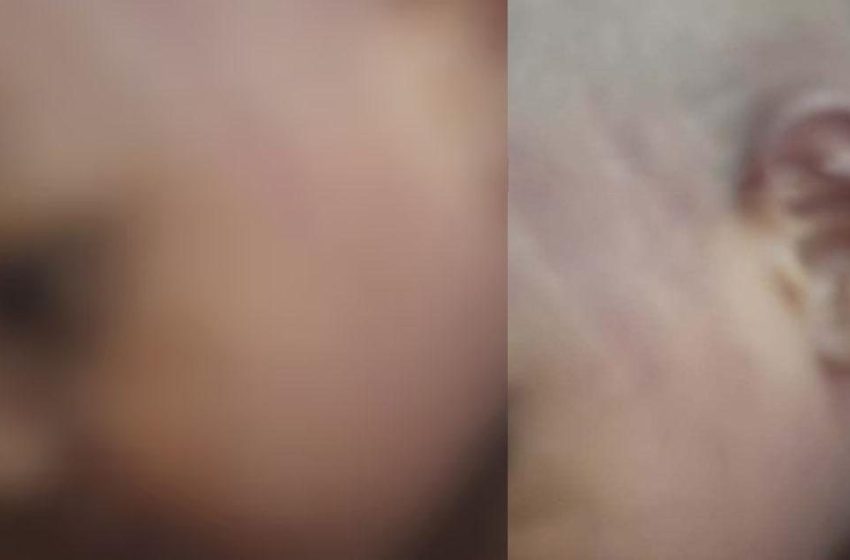  തിരുവനന്തപുരം പിഞ്ചുകുഞ്ഞിനെ ക്രൂരമായി മര്‍ദിച്ച അങ്കണവാടി ടീച്ചര്‍ക്കെതിരെ പൊലീസ് കേസെടുത്തു