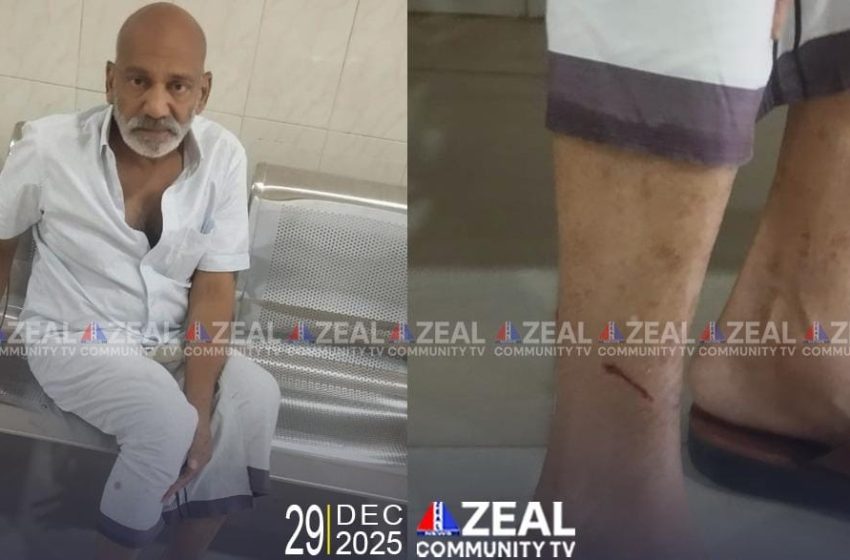  കണ്ണൂർ മുഴപ്പിലങ്ങാട് പാച്ചക്കര ഹുസ്സൻമുക്കിൽ മധ്യവയസ്കന് തെരുവ് നായയുടെ കടിയേറ്റു