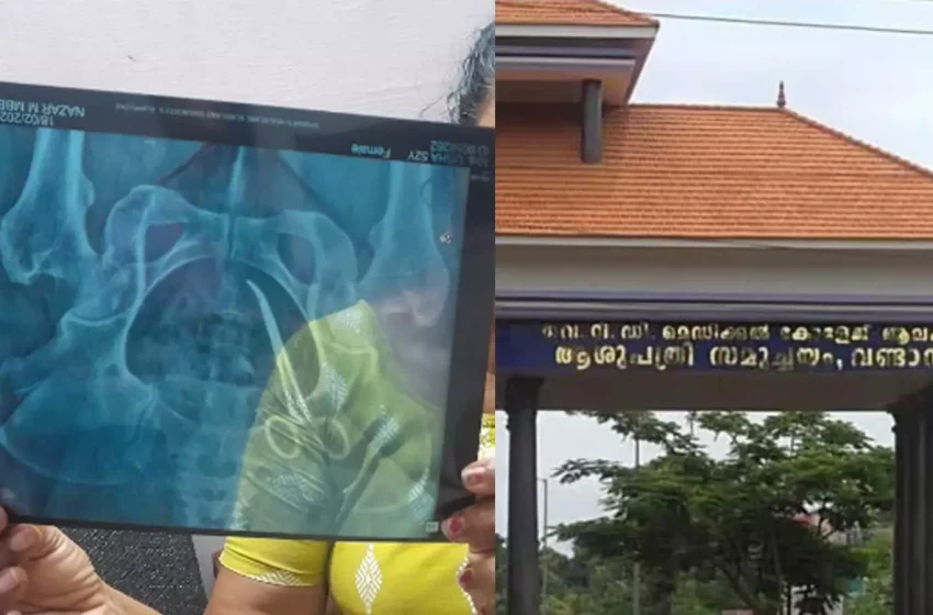  ആലപ്പുഴ പുന്നപ്രയില്‍ മെഡിക്കൽ കോളജിൽ ശസ്ത്രക്രിയക്കിടെ സ്ത്രീയുടെ വയറ്റില്‍ കത്രിക കുടുങ്ങി